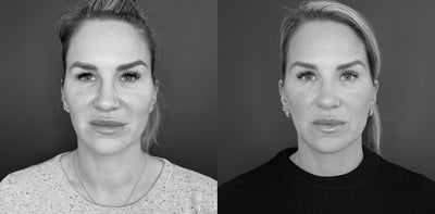 Skin Agency Face Lifts